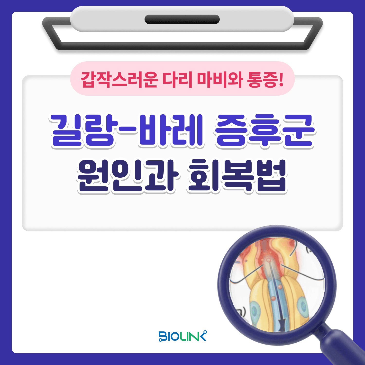 길랑-바레 증후군