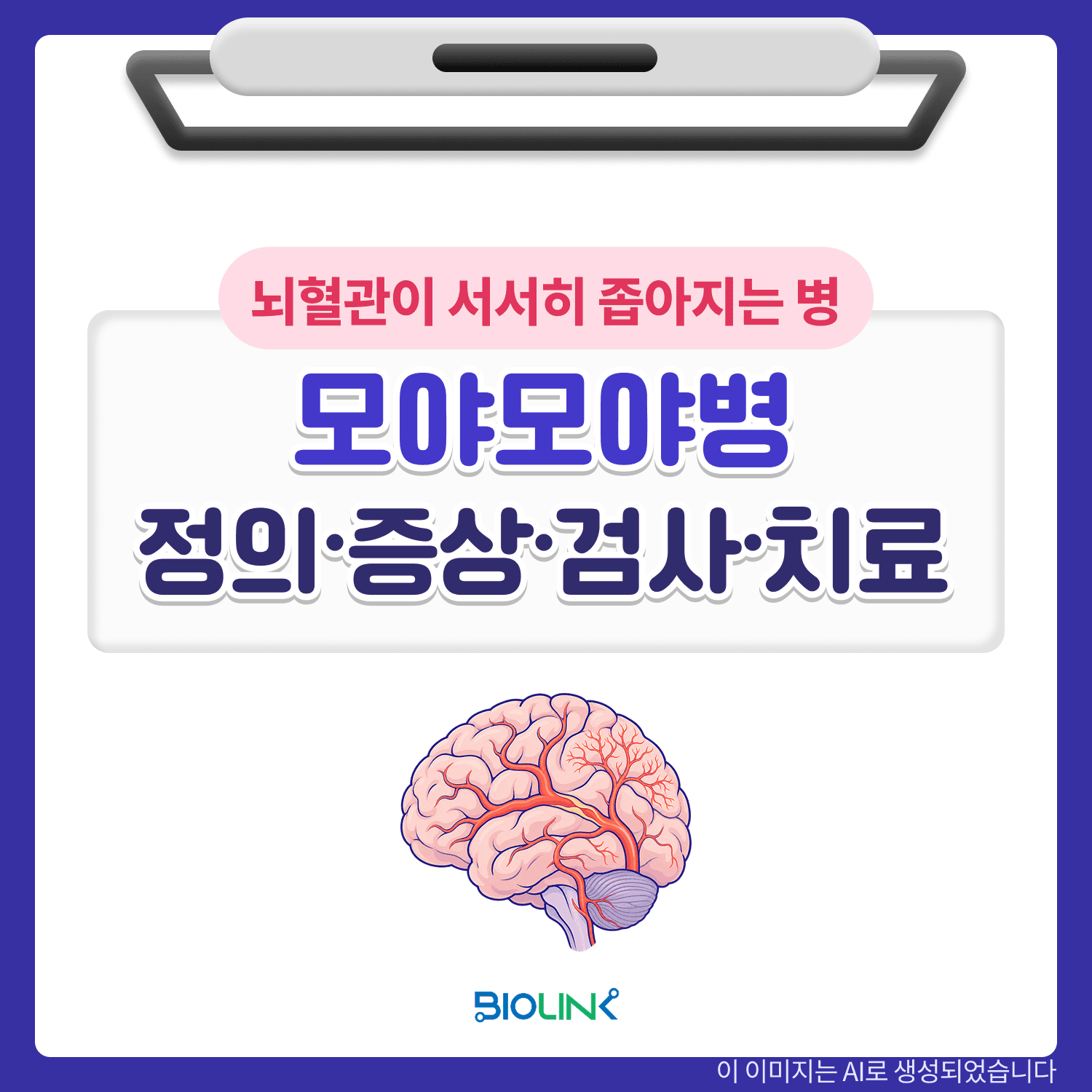모야모야병